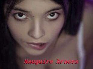 Nauguire_braces